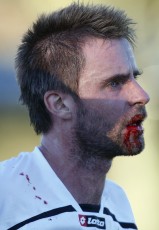Bloody Mess: Ngaruawahia's Mark Phillips spills blood. NRFL Northern Region Football League Premier Division, Forrest Hill Milford AFC v Ngaruawahia Utd AFC, Becroft Park, Forrest Hill, Saturday 10th July 2010. Photo: Shane Wenzlick